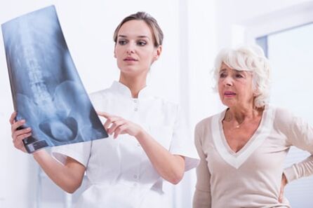 Η ακτινογραφία είναι μια ενημερωτική μέθοδος για τη διάγνωση της οστεοχονδρωσίας της σπονδυλικής στήλης