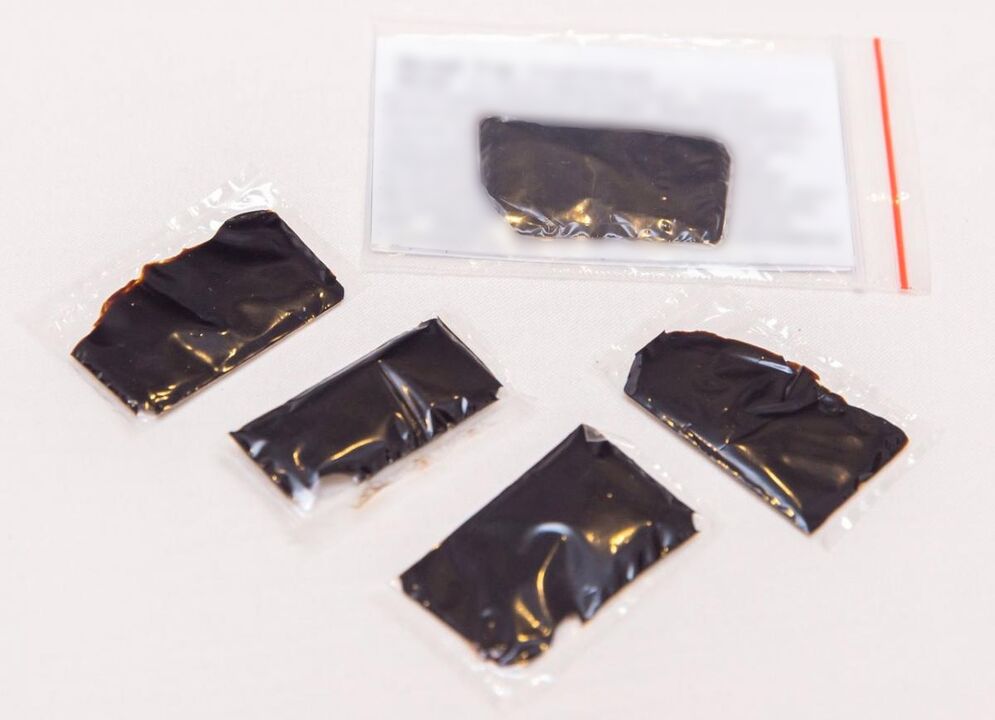 Το Shilajit είναι ένα αποτελεσματικό φάρμακο για τη θεραπεία της οστεοχονδρωσίας του τραχήλου της μήτρας στο σπίτι